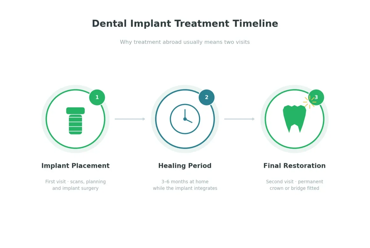 Dental implant treatment timeline showing implant placement, healing period, and final restoration